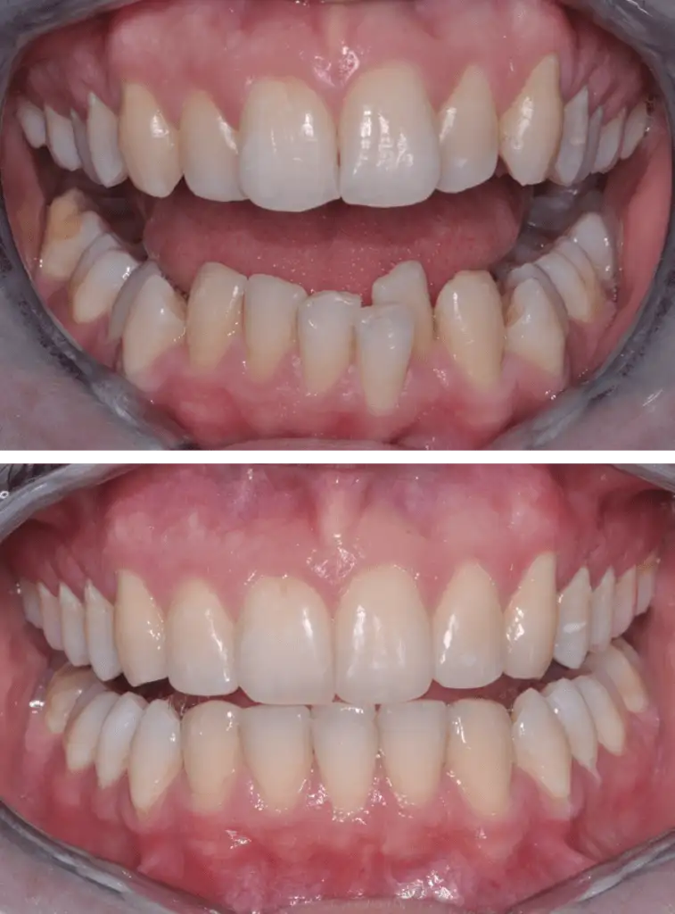 ortodonzia a Legnago - Studio dentistico Ferlin