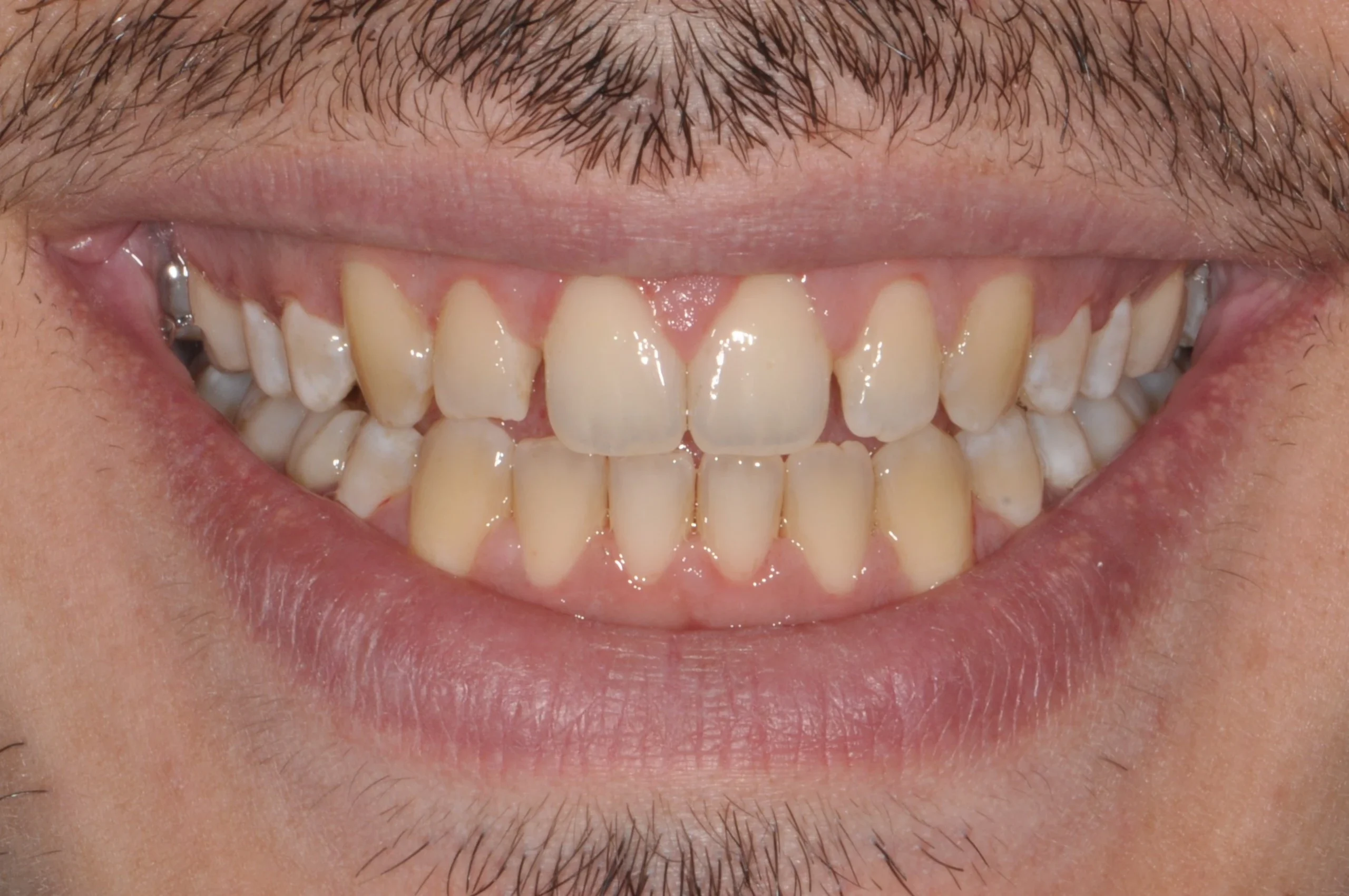 Before image alt