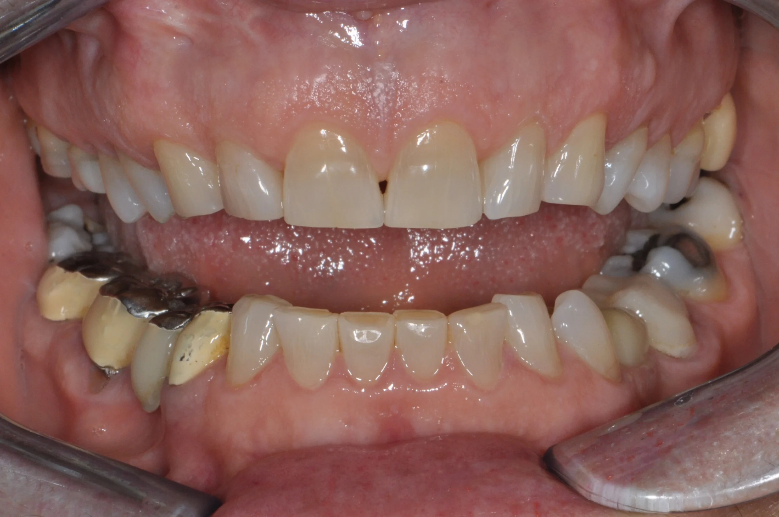 Before image alt